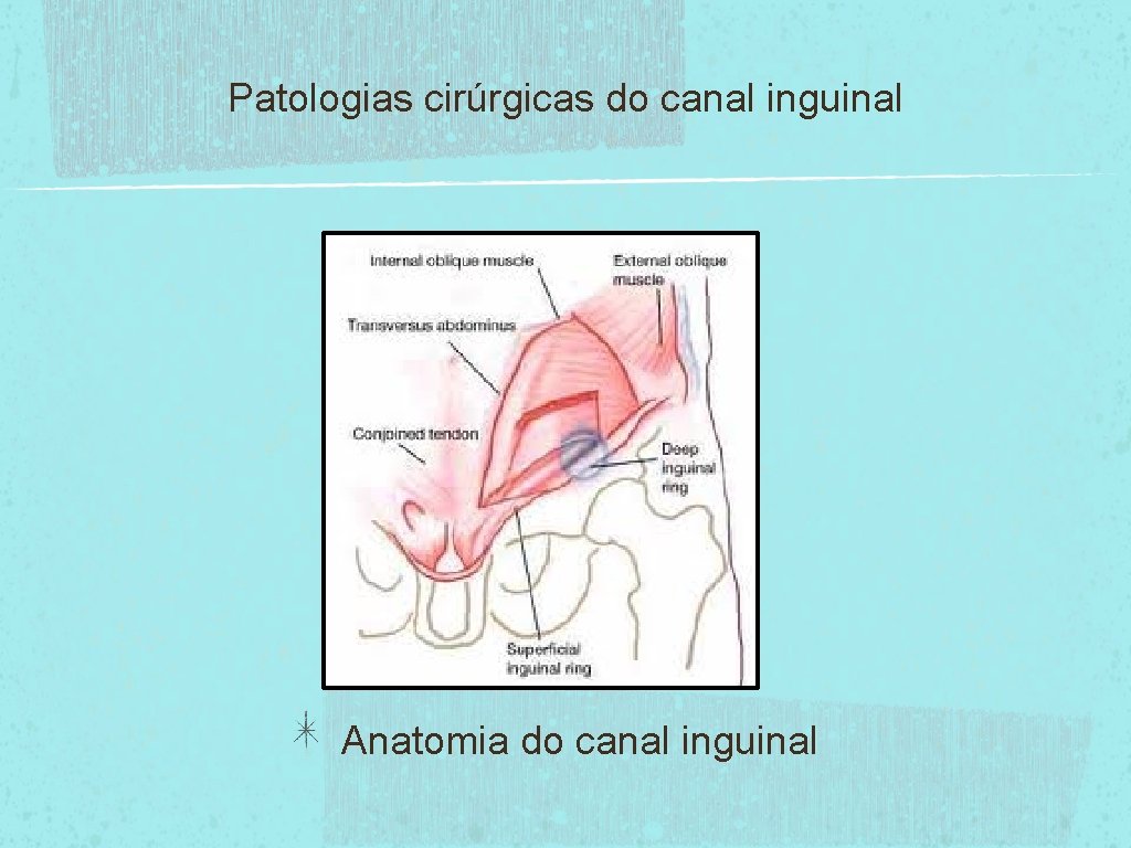 Patologias cirúrgicas do canal inguinal Anatomia do canal inguinal 