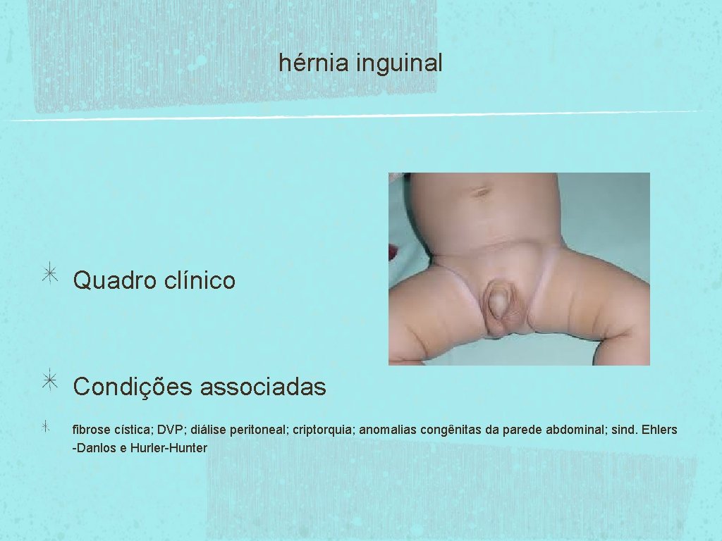 hérnia inguinal Quadro clínico Condições associadas fibrose cística; DVP; diálise peritoneal; criptorquia; anomalias congênitas