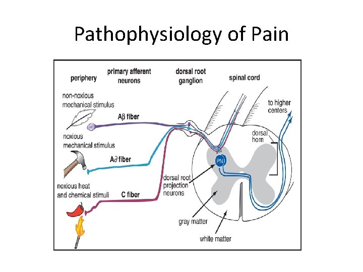 Pathophysiology of Pain Pathophysiology of Pain