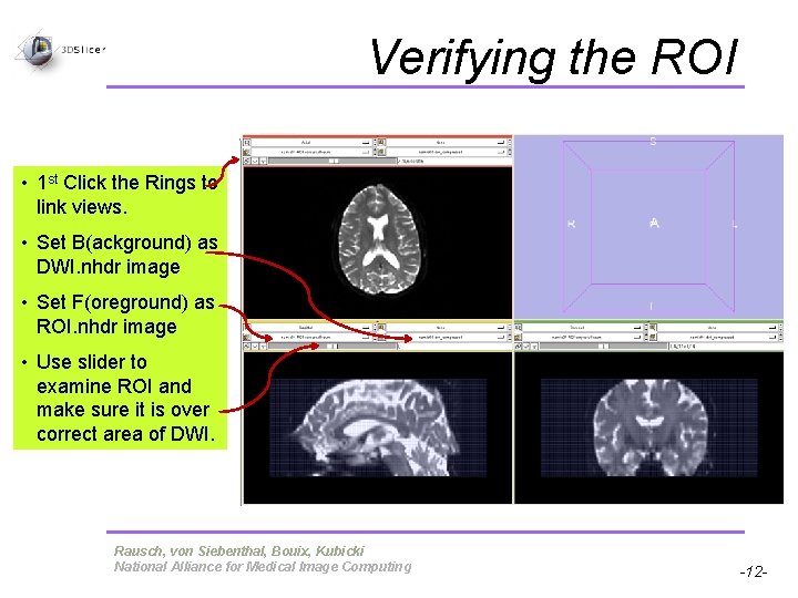 Verifying the ROI • 1 st Click the Rings to link views. • Set Verifying the ROI • 1 st Click the Rings to link views. • Set