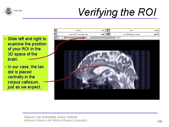 Verifying the ROI • Slide left and right to examine the position of your Verifying the ROI • Slide left and right to examine the position of your
