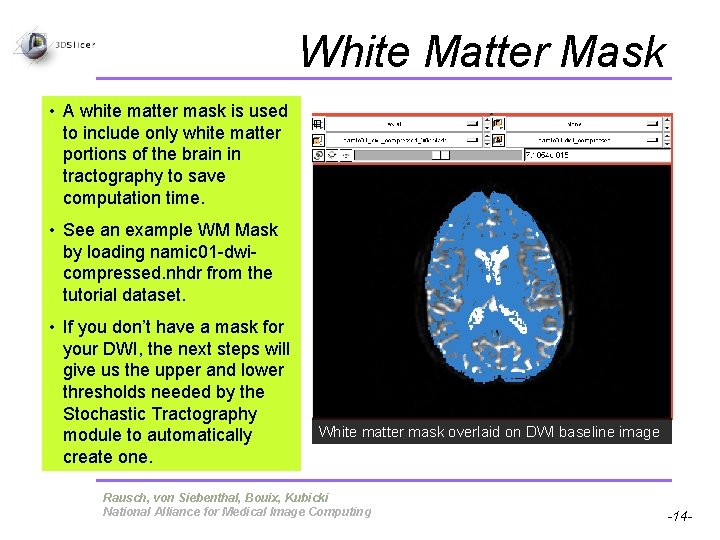 White Matter Mask • A white matter mask is used to include only white White Matter Mask • A white matter mask is used to include only white