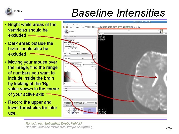 Baseline Intensities • Bright white areas of the ventricles should be excluded • Dark Baseline Intensities • Bright white areas of the ventricles should be excluded • Dark