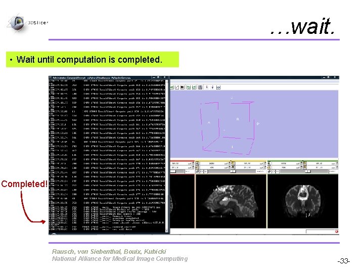 …wait. • Wait until computation is completed. Completed! Pujol S, Gollub R Rausch, von …wait. • Wait until computation is completed. Completed! Pujol S, Gollub R Rausch, von