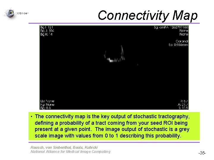 Connectivity Map • The connectivity map is the key output of stochastic tractography, defining Connectivity Map • The connectivity map is the key output of stochastic tractography, defining