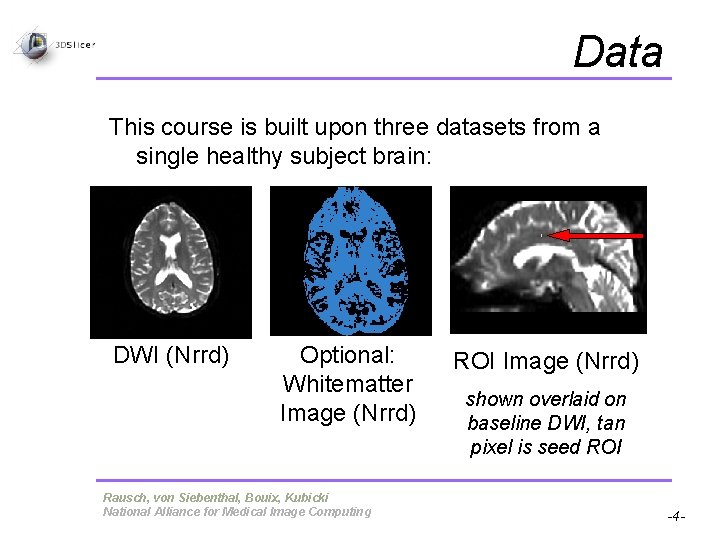 Data This course is built upon three datasets from a single healthy subject brain: Data This course is built upon three datasets from a single healthy subject brain: