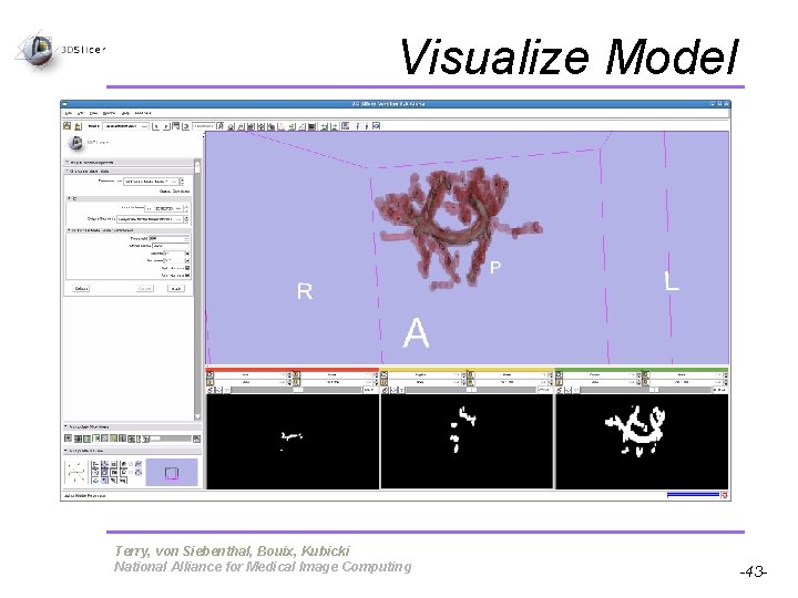 Visualize Model Pujol S, Gollub R Terry, von Siebenthal, Bouix, Kubicki National Alliance for Visualize Model Pujol S, Gollub R Terry, von Siebenthal, Bouix, Kubicki National Alliance for