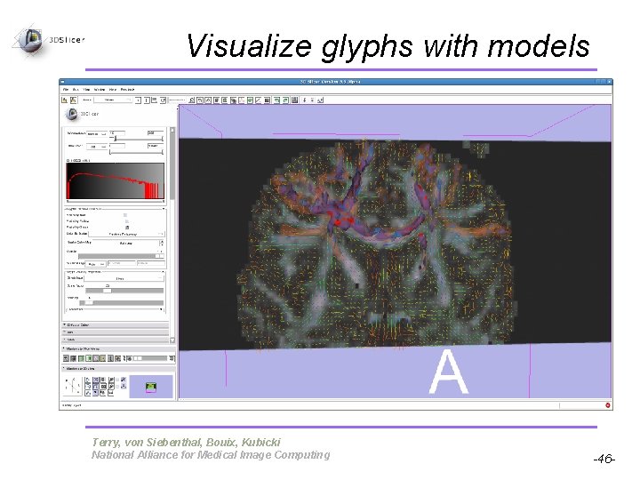 Visualize glyphs with models Pujol S, Gollub R Terry, von Siebenthal, Bouix, Kubicki National Visualize glyphs with models Pujol S, Gollub R Terry, von Siebenthal, Bouix, Kubicki National