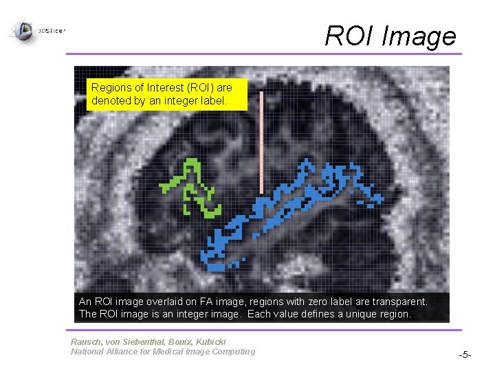 ROI Image Regions of Interest (ROI) are denoted by an integer label. An ROI ROI Image Regions of Interest (ROI) are denoted by an integer label. An ROI