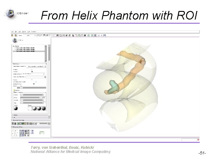 From Helix Phantom with ROI Pujol S, Gollub R Terry, von Siebenthal, Bouix, Kubicki From Helix Phantom with ROI Pujol S, Gollub R Terry, von Siebenthal, Bouix, Kubicki