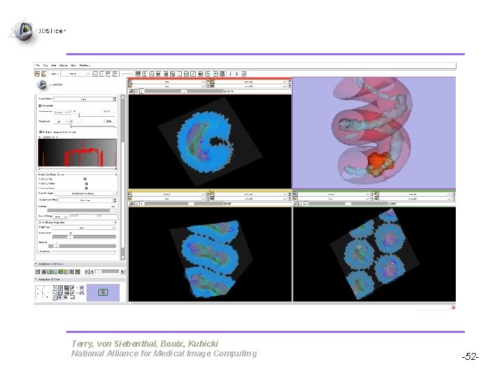 Pujol S, Gollub R Terry, von Siebenthal, Bouix, Kubicki National Alliance for Medical Image Pujol S, Gollub R Terry, von Siebenthal, Bouix, Kubicki National Alliance for Medical Image