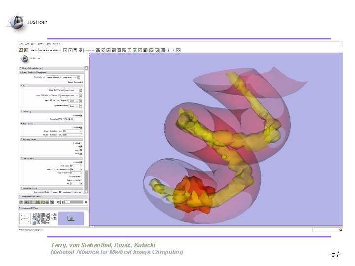 Pujol S, Gollub R Terry, von Siebenthal, Bouix, Kubicki National Alliance for Medical Image Pujol S, Gollub R Terry, von Siebenthal, Bouix, Kubicki National Alliance for Medical Image