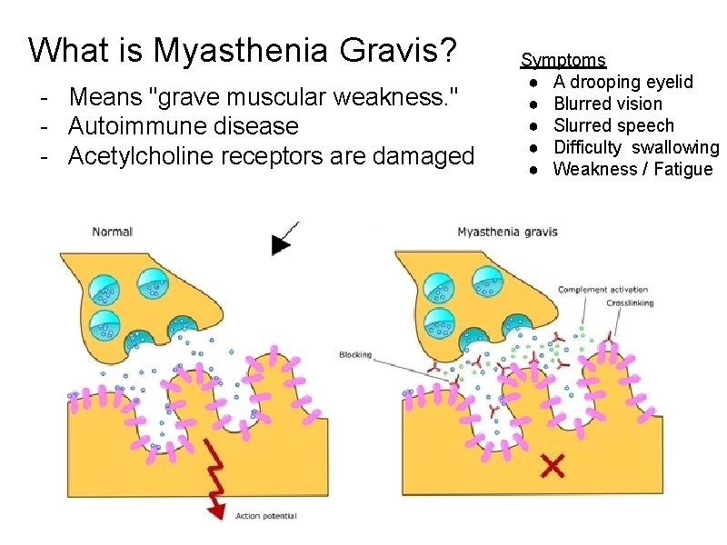 What is Myasthenia Gravis? - Means "grave muscular weakness. " - Autoimmune disease -