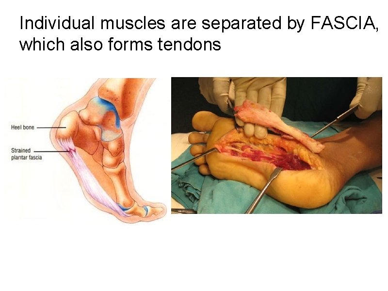 Individual muscles are separated by FASCIA, which also forms tendons 
