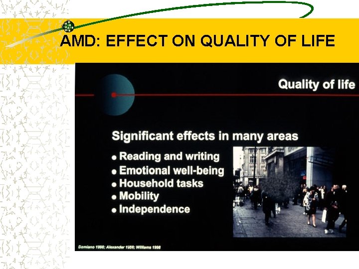 AMD: EFFECT ON QUALITY OF LIFE 