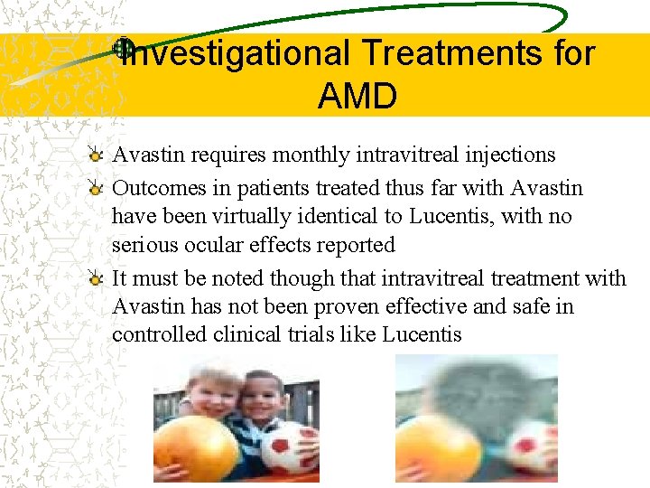 Investigational Treatments for AMD Avastin requires monthly intravitreal injections Outcomes in patients treated thus