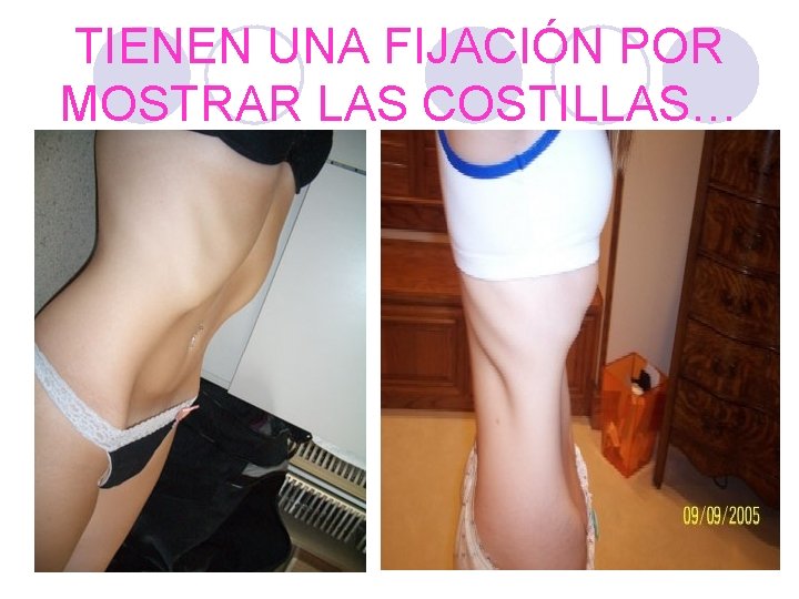 TIENEN UNA FIJACIÓN POR MOSTRAR LAS COSTILLAS… 