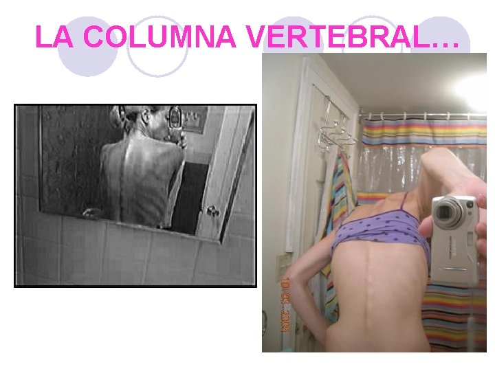 LA COLUMNA VERTEBRAL… 