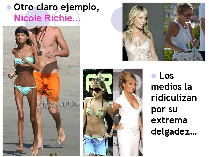 l Otro claro ejemplo, Nicole Richie… Los medios la ridiculizan por su extrema delgadez…