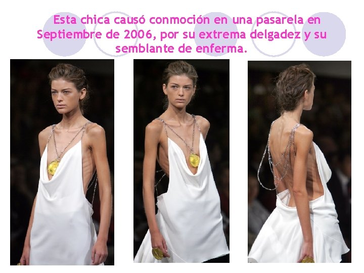 Esta chica causó conmoción en una pasarela en Septiembre de 2006, por su extrema