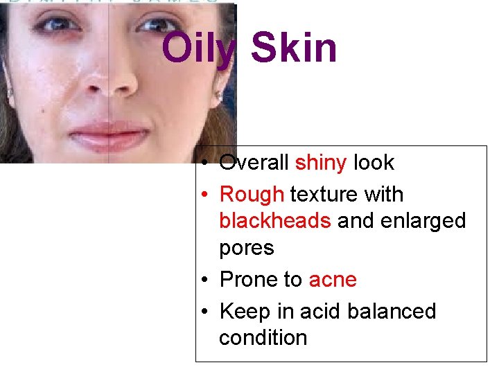 Oily Skin • Overall shiny look • Rough texture with blackheads and enlarged pores