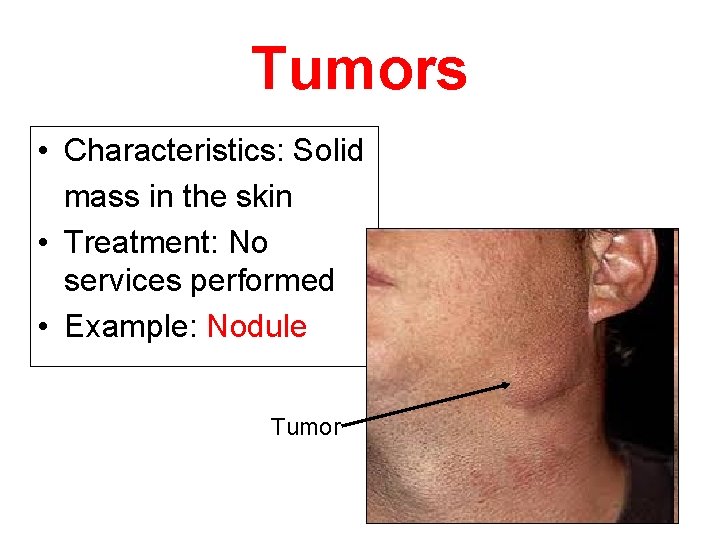 Tumors • Characteristics: Solid mass in the skin • Treatment: No services performed •