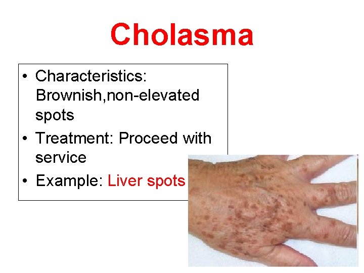 Cholasma • Characteristics: Brownish, non-elevated spots • Treatment: Proceed with service • Example: Liver