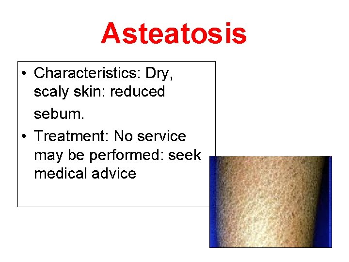 Asteatosis • Characteristics: Dry, scaly skin: reduced sebum. • Treatment: No service may be