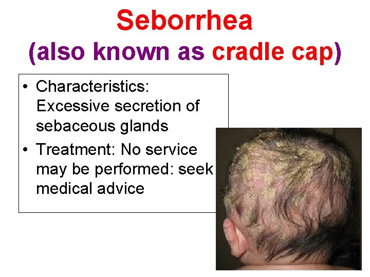 Seborrhea (also known as cradle cap) • Characteristics: Excessive secretion of sebaceous glands •