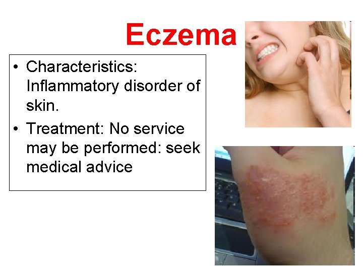 Eczema • Characteristics: Inflammatory disorder of skin. • Treatment: No service may be performed: