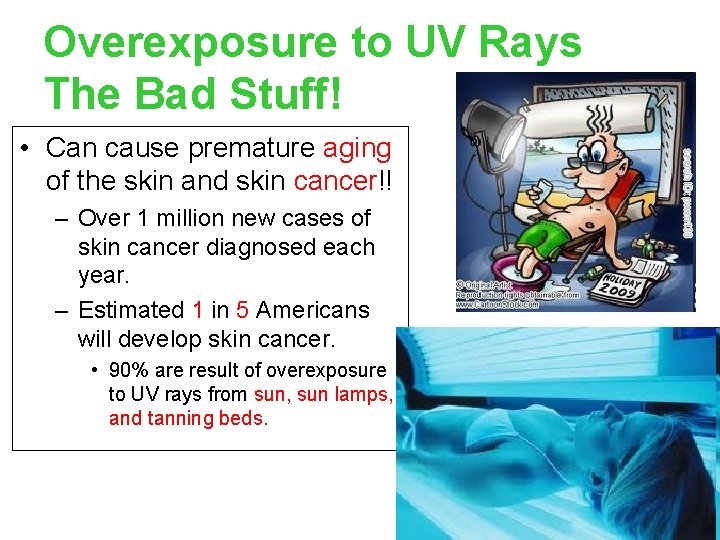 Overexposure to UV Rays The Bad Stuff! • Can cause premature aging of the