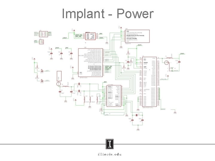 Implant - Power 