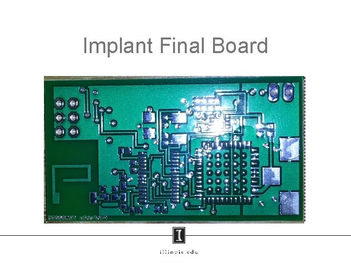 Implant Final Board 