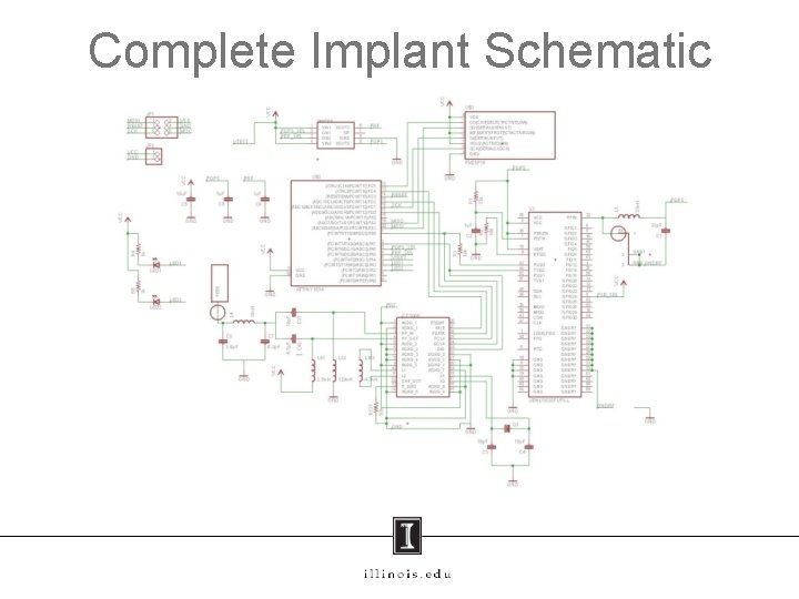 Complete Implant Schematic 