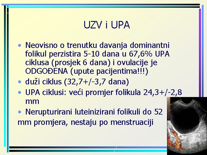 UZV i UPA • Neovisno o trenutku davanja dominantni folikul perzistira 5 -10 dana