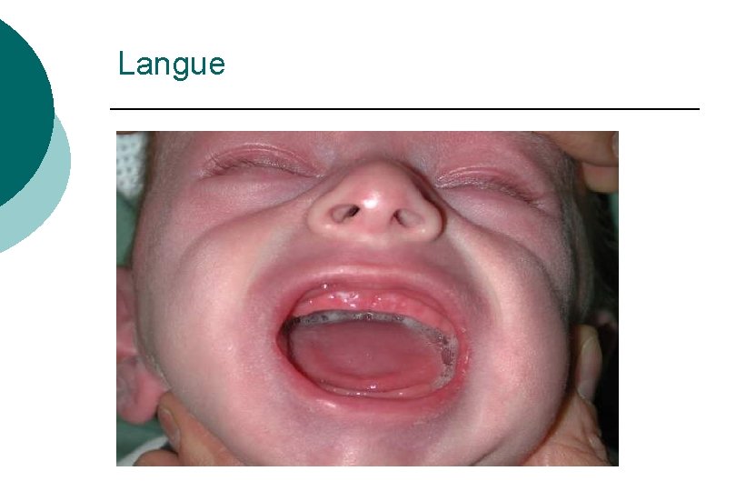 Langue Langue
