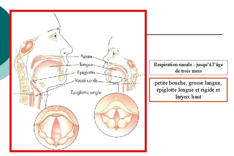 Respiration nasale : jusqu’à l’âge de trois mois petite bouche, grosse langue, épiglotte longue Respiration nasale : jusqu’à l’âge de trois mois petite bouche, grosse langue, épiglotte longue