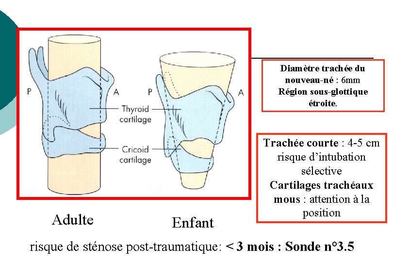 Diamètre trachée du nouveau-né : 6 mm Région sous-glottique étroite. Adulte Enfant Trachée courte Diamètre trachée du nouveau-né : 6 mm Région sous-glottique étroite. Adulte Enfant Trachée courte
