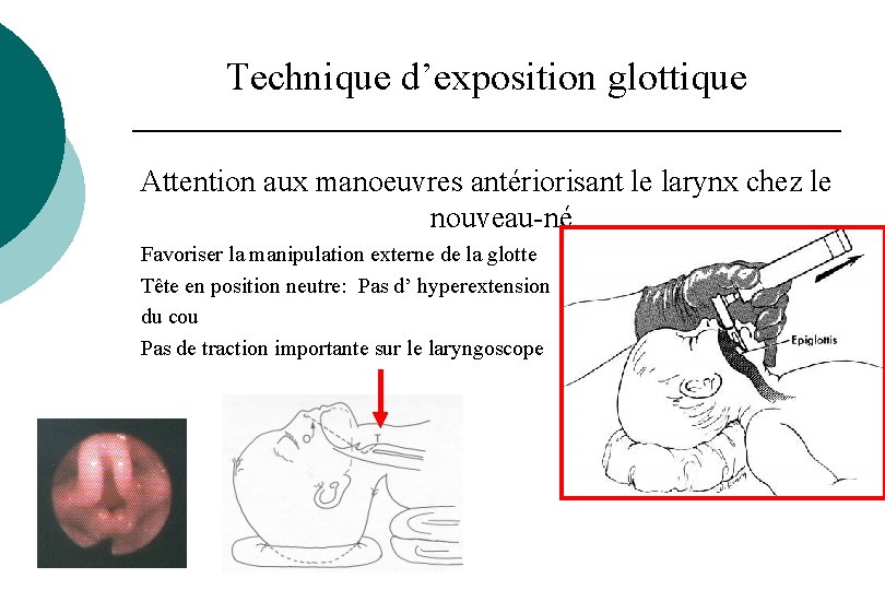 Physiologie Nonatale Et Du Nourrisson Des 12 Juin