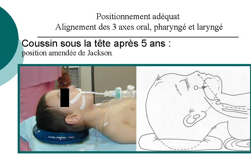 Positionnement adéquat Alignement des 3 axes oral, pharyngé et laryngé Coussin sous la tête Positionnement adéquat Alignement des 3 axes oral, pharyngé et laryngé Coussin sous la tête