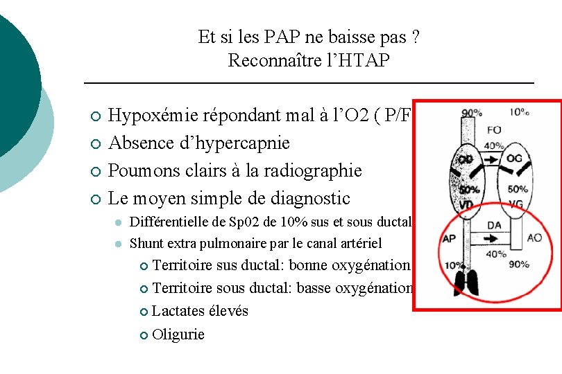 Et si les PAP ne baisse pas ? Reconnaître l’HTAP ¡ ¡ Hypoxémie répondant Et si les PAP ne baisse pas ? Reconnaître l’HTAP ¡ ¡ Hypoxémie répondant