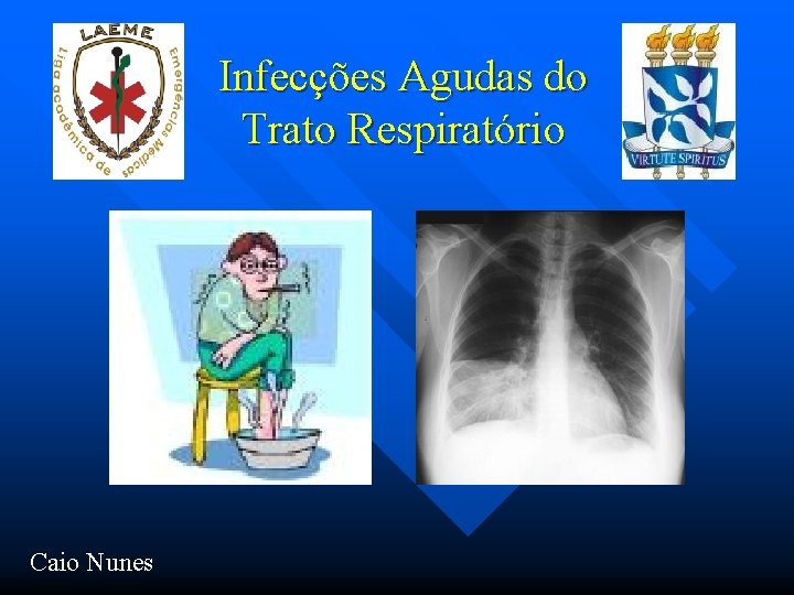 Infecções Agudas do Trato Respiratório Caio Nunes 