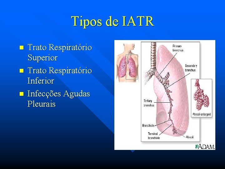 Tipos de IATR n n n Trato Respiratório Superior Trato Respiratório Inferior Infecções Agudas