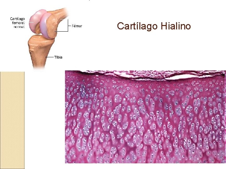 Cartílago Hialino 