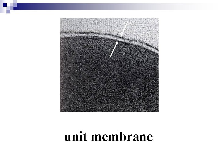 unit membrane 