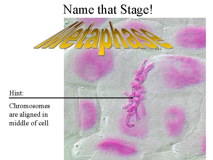 Name that Stage! Hint: Chromosomes are aligned in middle of cell 