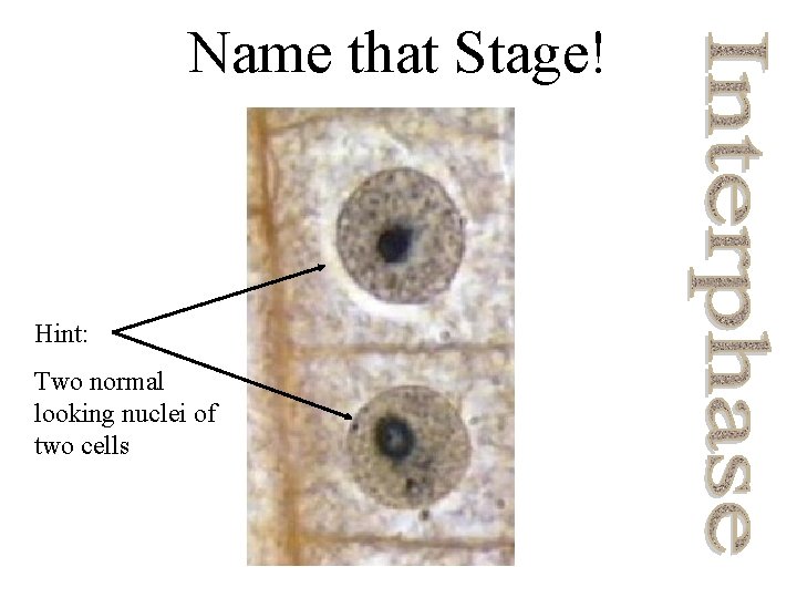 Name that Stage! Hint: Two normal looking nuclei of two cells 