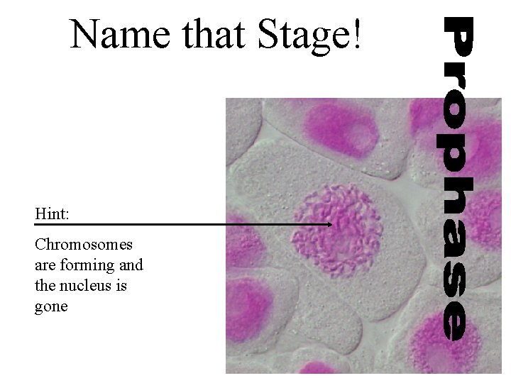 Name that Stage! Hint: Chromosomes are forming and the nucleus is gone 