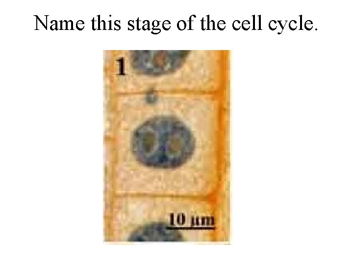 Name this stage of the cell cycle. 