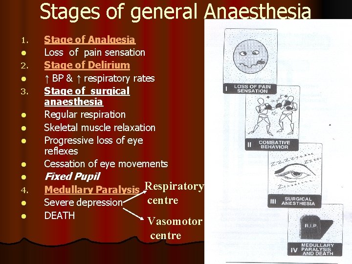 Stages of general Anaesthesia l Stage of Analgesia Loss of pain sensation Stage of Stages of general Anaesthesia l Stage of Analgesia Loss of pain sensation Stage of